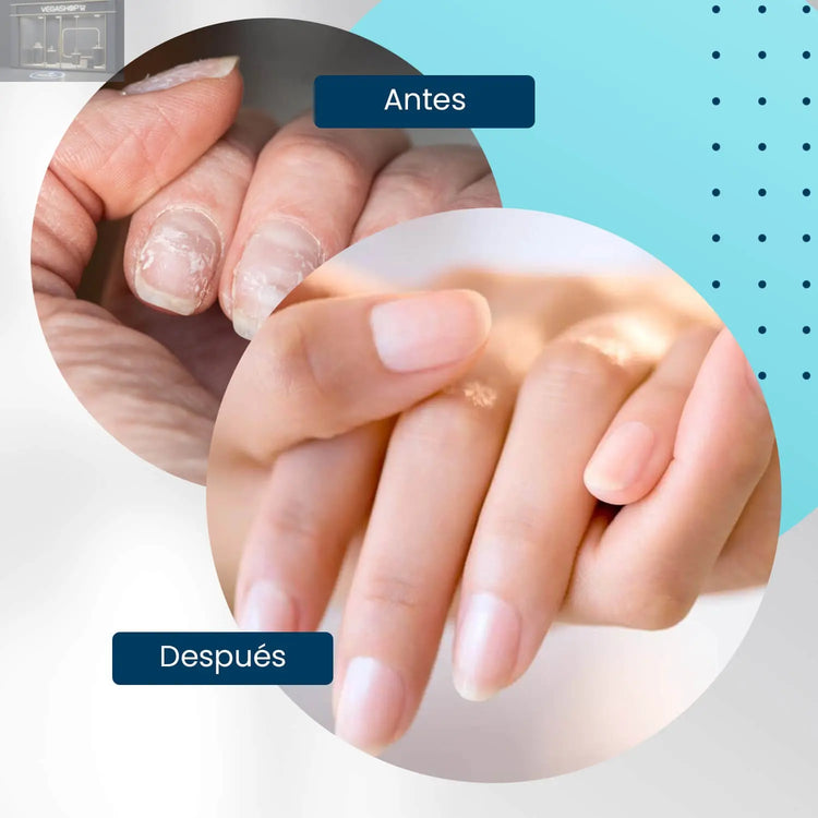 Nail Hardener 15 ml- Endurecedor de uñas - Nooves Nails-4