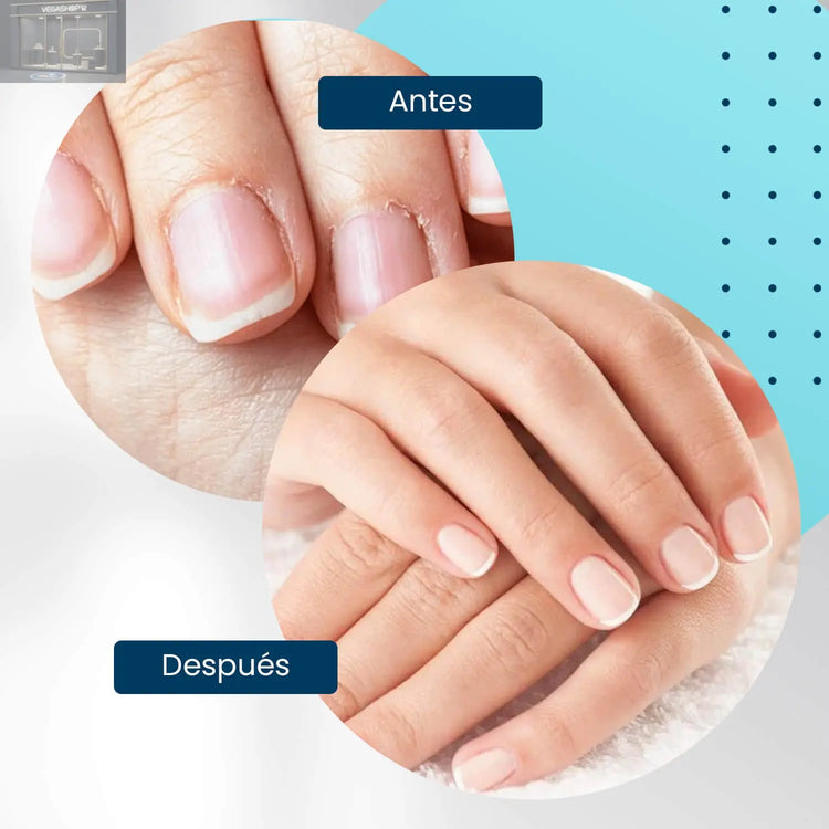 Cuticle Oil Strawberry Roll On 10ml - Aceite para cutículas Aroma Fresa - Nooves Nails NOOVES NOOVES Cuticle Oil Strawberry Roll On 10ml - Aceite para cutículas Aroma Fresa - Nooves Nails